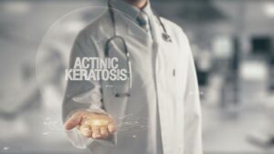 Actinic Keratosis: A Comprehensive Guide with Key Facts to know
