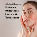 All about Rosacea