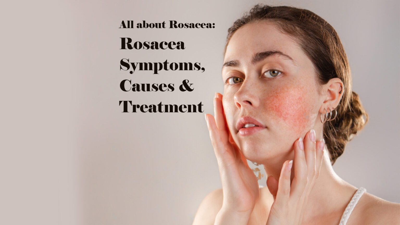 All about Rosacea