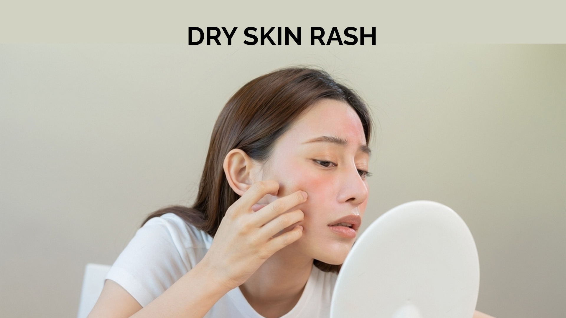 Dry Skin Rash