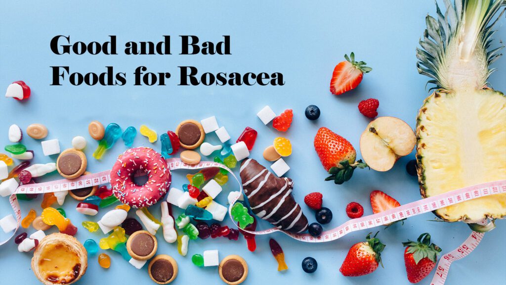 Good and Bad Foods for Rosacea