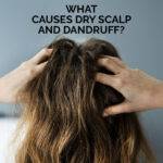 What Causes Dry Scalp And Dandruff?