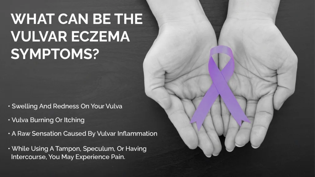 What can be the Vulvar Eczema Symptoms