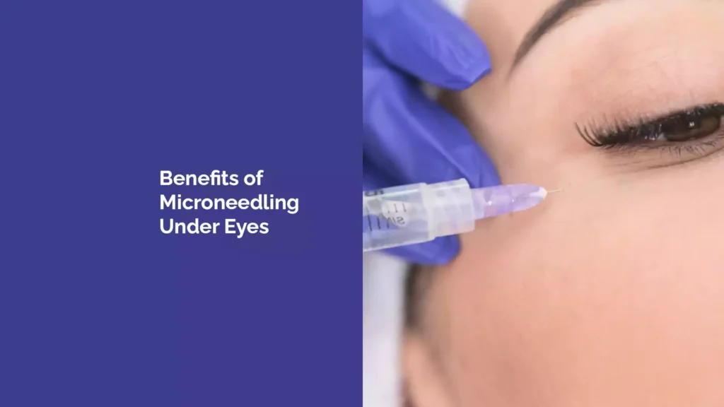 Benefits of Microneedling Under Eyes