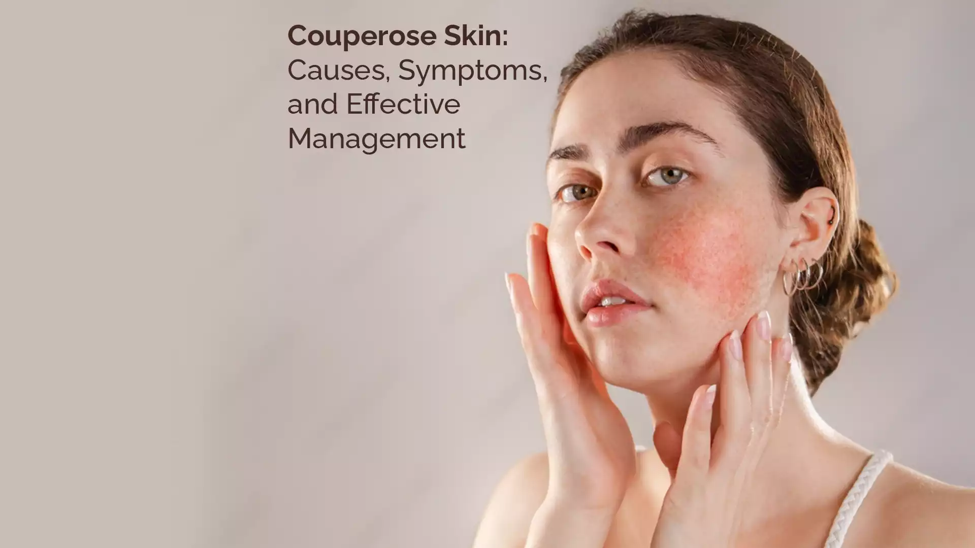 Couperose Skin