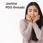 Jawline PDO threads